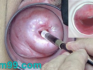 Japanese Endoscope Camera medial Cervix Cam purchase Vagina